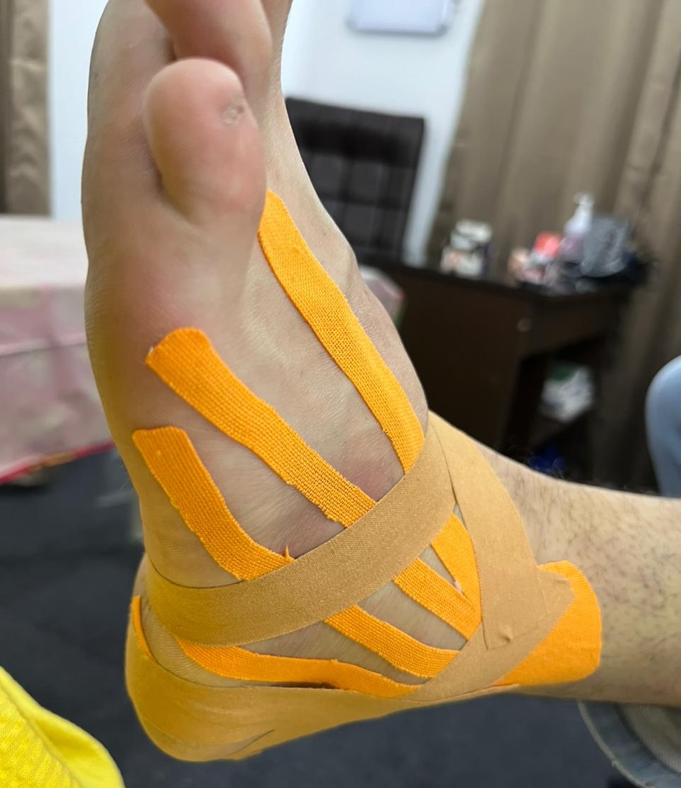 Kinesio Taping on a patient